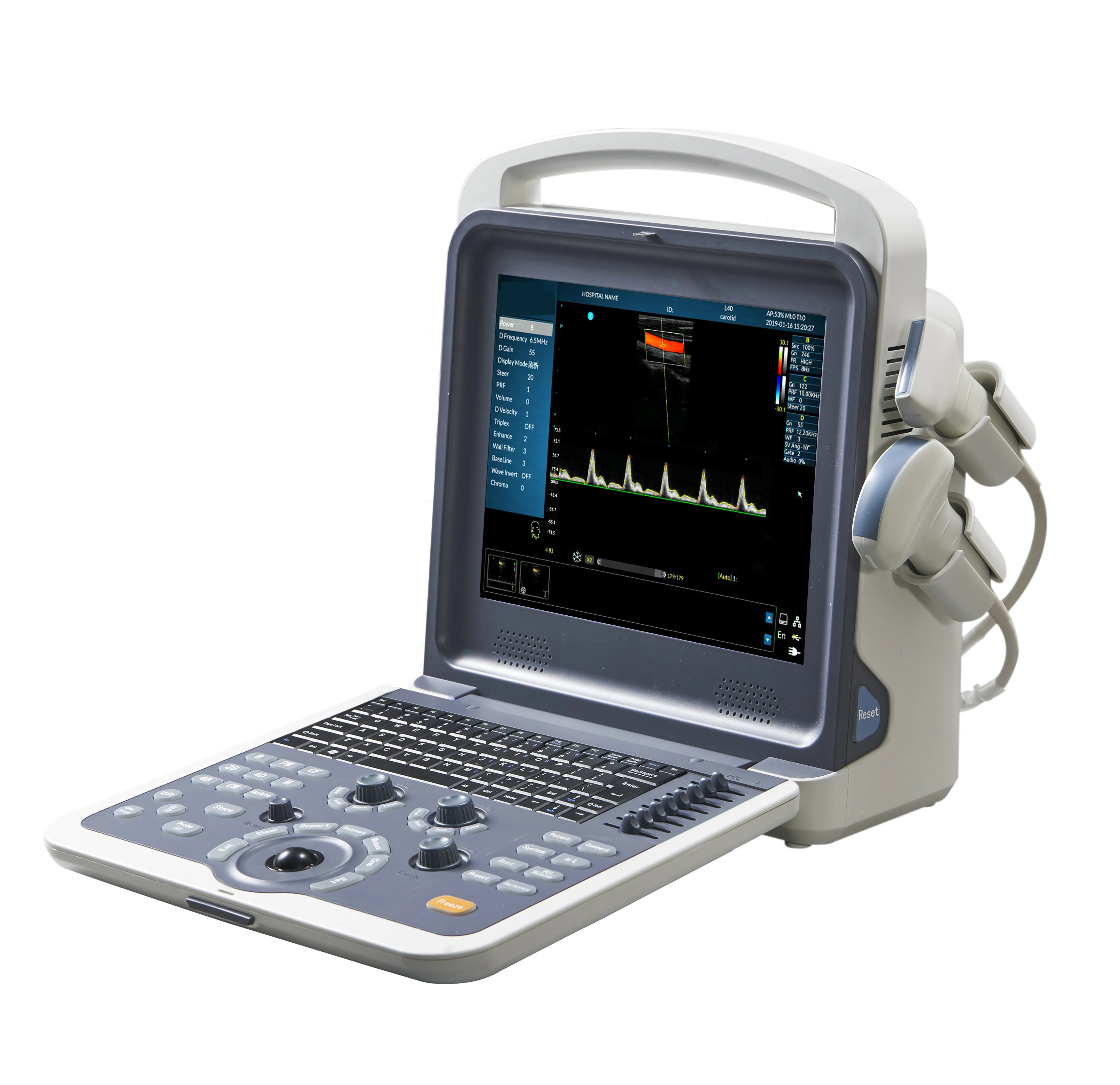 Veľkoobchod usg notebook a sonda farebný doppler 120 G pamäte ultrazvuk diagnostický systém - 0