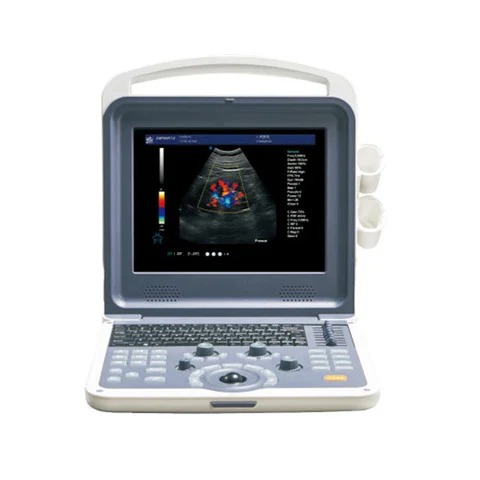 Veľkoobchod usg notebook a sonda farebný doppler 120 G pamäte ultrazvuk diagnostický systém - 1