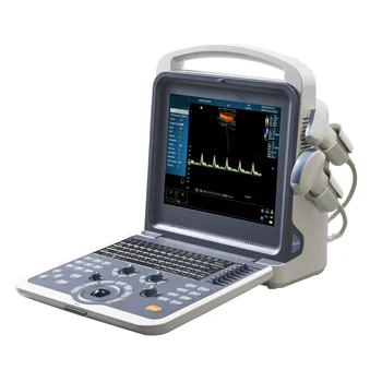 Veľkoobchod usg notebook a sonda farebný doppler 120 G pamäte ultrazvuk diagnostický systém